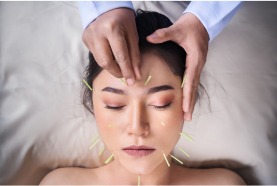 ACUPUNCTURE-TREATMENT